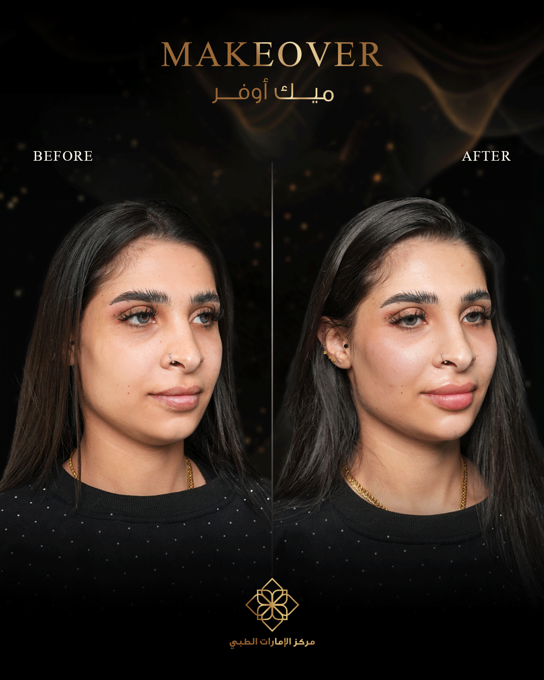 EMIRATES-MC-Before-AfterArtboard-4